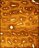 Se&ccedil;&atilde;o de osso fino
